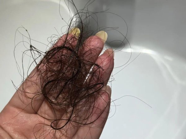 广禾配资 崩溃! 大量年轻人涌入门诊: 20多岁就这样了